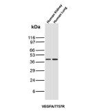Vascular Endothelial Growth Factor Antibody Human Tissue WB. Western blot analysis of human kidney and human lung tissue lysates using Vascular Endothelial Growth Factor Antibody / VEGF (clone VEGFA/7757R). Lane 1: human kidney tissue lysate, Lane 2: human lung tissue lysate. An HRP-conjugated secondary antibody with ECL substrate was used for detection. This recombinant rabbit monoclonal Vascular Endothelial Growth Factor Antibody detects VEGFA protein expression, supporting studies of angiogenesis, endothelial cell signaling, vascular remodeling, and VEGF-mediated regulation of tissue development and homeostasis.