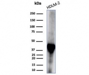 STING1 Antibody Clone STING1/7439 western blot analysis. Western blot analysis of human HDLM-2 cell lysate using STING1 Antibody Clone STING1/7439 detects a band at approximately 42 kDa, consistent with the predicted molecular weight of Stimulator of interferon genes protein / STING1 (TMEM173), a cytosolic DNA sensing adaptor involved in cGAS-STING innate immune signaling.