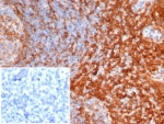 IHC staining of FFPE human tonsil tissue with STING1 antibody STING1/7439. Inset: PBS used in place of primary Ab (secondary Ab negative control). HIER: boil tissue sections in pH 9 10mM Tris with 1mM EDTA for 20 min and allow to cool before testing.