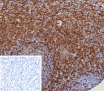 MITA Antibody STING1/8129R immunohistochemistry analysis of human tissue. IHC staining of formalin-fixed, paraffin-embedded human tonsil using MITA Antibody STING1/8129R demonstrates HRP-DAB brown cytoplasmic staining in numerous immune cells consistent with expression of Mediator of IRF3 activation / STING1 (TMEM173) in antigen-presenting immune cell populations within lymphoid tissue. Heat-induced epitope retrieval was performed by boiling tissue sections in pH 9 10 mM Tris with 1 mM EDTA for 20 min followed by cooling prior to antibody incubation. The inset shows PBS used in place of primary antibody as a negative control.