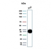 Western blot testing of human Raji cell lysate with CD74 antibody. Expected molecular weight: 33-43 kDa.
