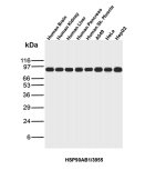 HSP90 beta Antibody HSP90AB1/3955 Multi-Tissue and Cancer Cell Expression WB. Western blot testing of human brain, kidney, liver, pancreas and skeletal muscle tissue lysates and A549 lung cancer, HeLa cervical cancer and HepG2 liver cancer cell lysates with HSP90 beta Antibody clone HSP90AB1/3955 shows a strong, specific band at approximately 90 kDa across all samples. The observed band is consistent with the expected molecular weight of HSP90AB1 and demonstrates broad HSP90 beta expression across the tested human tissues and cancer cell lines.