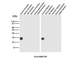 HLA-DRB Antibody rHLA-DRB/7198 Shows Human-Specific Detection in Intestine and Spleen WB. Western blot testing of human, mouse, rat, guinea pig and rabbit intestine and spleen tissue lysates with HLA-DRB Antibody clone rHLA-DRB/7198. Strong, discrete bands are detected at approximately 27-28 kDa in human intestine and spleen, while no corresponding signal is observed in the tested mouse, rat, guinea pig or rabbit samples, demonstrating selective detection of the human HLA-DR beta-chain component under the tested conditions.