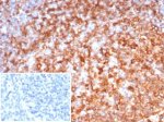 HLA-DRB Antibody rHLA-DRB/7198 in Human Tonsil IHC. Immunohistochemistry staining of FFPE human tonsil tissue with HLA-DRB Antibody clone rHLA-DRB/7198. Heat-induced epitope retrieval was performed by boiling tissue sections in 10 mM Tris with 1 mM EDTA, pH 9, for 20 min followed by cooling before testing. Strong, widespread HLA-DRB immunoreactivity is observed in numerous lymphoid cells throughout the tonsil, with prominent membrane-associated staining. The inset shows the secondary-only negative control, in which PBS was substituted for the primary antibody and minimal staining is observed.