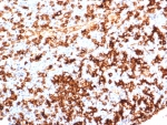 HLA-DR Antibody Recombinant Rabbit MAb HLA-DRA/6839R immunohistochemistry staining of human tonsil tissue. IHC analysis of FFPE human tonsil was performed using recombinant rabbit monoclonal HLA-DR antibody clone HLA-DRA/6839R following heat induced epitope retrieval by boiling tissue sections in pH 9 10mM Tris with 1mM EDTA for 20 min and allowing sections to cool before testing. HRP-DAB brown staining highlights HLA-DR positive immune cells within tonsillar lymphoid tissue, consistent with expression of Human leukocyte antigen DR alpha / HLA-DRA on antigen-presenting cells including B lymphocytes and other immune cells.