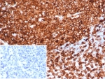 HLA-DR Antibody Recombinant Rabbit MAb HLA-DRA/6839R immunohistochemistry staining of human tonsil tissue. IHC analysis of FFPE human tonsil demonstrates strong HRP-DAB brown staining of numerous lymphoid cells using recombinant rabbit monoclonal HLA-DR antibody clone HLA-DRA/6839R. Heat induced epitope retrieval was performed by boiling tissue sections in pH 9 10mM Tris with 1mM EDTA for 20 min followed by cooling prior to staining. The membranous and cytoplasmic staining pattern highlights HLA-DR expressing immune cells within tonsillar lymphoid follicles, consistent with expression of Human leukocyte antigen DR alpha / HLA-DRA in antigen-presenting B lymphocytes and other immune cell populations. Inset shows PBS used in place of primary antibody as a negative control.