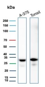 HLA-DR Antibody Rabbit Monoclonal HLA-DRA/6840R in Human A-375 Melanoma and Tonsil WB. Western blot testing of human 1) A-375 melanoma cell and 2) tonsil tissue lysates with HLA-DR Antibody Rabbit Monoclonal HLA-DRA/6840R. Strong, discrete bands are detected at approximately 30-32 kDa in both samples, consistent with the expected molecular weight of the HLA-DR alpha-chain component.