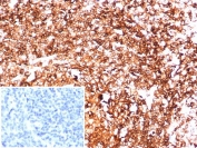 HLA-DR Antibody Rabbit Monoclonal for IHC HLA-DRA/6844R immunohistochemistry staining of human tonsil tissue. IHC analysis of FFPE human tonsil demonstrates widespread HRP-DAB brown staining of lymphoid cells using rabbit monoclonal HLA-DR antibody clone HLA-DRA/6844R. Heat induced epitope retrieval was performed by boiling tissue sections in pH 9 10mM Tris with 1mM EDTA for 20 min followed by cooling before staining. The staining pattern highlights membranous and cytoplasmic signal in antigen-presenting immune cells within tonsillar lymphoid tissue, consistent with expression of Human leukocyte antigen DR alpha / HLA-DRA. Inset shows PBS used in place of primary antibody as a secondary antibody negative control.