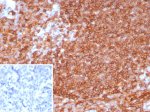 HLA-DR Antibody in Human Tonsil IHC. Immunohistochemistry staining of FFPE human tonsil tissue with HLA-DR Antibody clone HLA-DRA/8287R. Strong, widespread HLA-DR immunoreactivity is observed in numerous lymphoid cells, with prominent membrane-associated staining. The inset shows the secondary-only negative control, in which PBS was substituted for the primary antibody and minimal staining is observed.