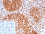HLA-DR Antibody Recombinant Rabbit MAb for IHC HLA-DRA/8286R immunohistochemistry staining of human tonsil tissue. IHC analysis of FFPE human tonsil demonstrates strong HRP-DAB brown staining of numerous lymphoid cells using recombinant rabbit monoclonal HLA-DR antibody clone HLA-DRA/8286R. Heat induced epitope retrieval was performed by boiling tissue sections in pH 9 10mM Tris with 1mM EDTA for 20 min followed by cooling prior to staining. The staining pattern highlights membranous and cytoplasmic signal in antigen-presenting immune cells within tonsillar lymphoid follicles, consistent with expression of Human leukocyte antigen DR alpha / HLA-DRA. Inset shows PBS used in place of primary antibody as a secondary antibody negative control.