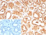 HSPA1A Antibody HSPA1A/7936 Staining of Human Kidney IHC. Immunohistochemistry testing of FFPE human kidney tissue with HSPA1A Antibody clone HSPA1A/7936 shows strong brown staining throughout the renal tubular epithelium, while the inset secondary antibody negative control shows minimal background signal. HIER was performed by boiling tissue sections in pH 9, 10 mM Tris with 1 mM EDTA for 20 min followed by cooling before antibody testing.