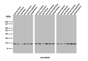 Allograft Inflammatory Factor 1 Antibody Multi-Species Tissue WB. Western blot analysis of brain, kidney, and spleen tissue lysates from human, mouse, rat, hamster, guinea pig, and rabbit using Allograft Inflammatory Factor 1 Antibody (clone AIF1/8970R) detects a band at the predicted molecular weight of approximately 17 kDa, consistent with AIF1 / IBA1 expression across multiple species and tissue types, supporting its use as a cross-species WB antibody for conserved detection of this macrophage and microglia marker.