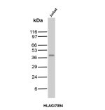 HLA-G Antibody HLAG/7094 Detection in Jurkat T Lymphocyte Cells WB. Western blot analysis of human Jurkat T lymphocyte cell lysate using HLA-G Antibody clone HLAG/7094. A discrete immunoreactive band is detected at approximately 40 kDa, consistent with the expected molecular weight of HLA-G. The result demonstrates recognition of endogenous HLA-G in human Jurkat cells.