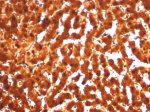ARG1 Antibody ARG1/7514R by IHC in Human Liver. Immunohistochemistry of FFPE human liver tissue using ARG1 Antibody ARG1/7514R. Strong brown DAB staining is observed throughout the hepatocyte cytoplasm, with relatively uniform expression across the hepatic parenchyma. The staining pattern is consistent with the abundant expression of arginase 1 in hepatocytes, where it catalyzes the final reaction of the urea cycle. Heat-induced epitope retrieval was performed by boiling tissue sections in 10 mM Tris with 1 mM EDTA, pH 9, for 20 minutes, followed by cooling before antibody incubation.