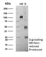 ARG1 Antibody ARG1/7514R by SDS-PAGE. SDS-PAGE analysis of purified ARG1 Antibody ARG1/7514R under non-reducing (NR) and reducing (R) conditions. The non-reducing lane shows a prominent band migrating near 100-110 kDa, while the reducing lane displays bands near 50 kDa and 25 kDa, corresponding to the expected immunoglobulin heavy and light chains. The image demonstrates the electrophoretic profile of the purified recombinant rabbit monoclonal antibody under the two conditions.