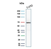 ER-A Antibody Recombinant Rabbit MAb T-47D WB. Western blot analysis of human T-47D cell lysate using Estrogen Receptor alpha antibody (clone ESR1/8407R) detects a band at approximately 65-70 kDa, consistent with the predicted molecular weight of Estrogen receptor alpha (ESR1), a nuclear hormone receptor expressed in hormone-responsive breast cancer cells; detection was performed with clone ESR1/8407R.