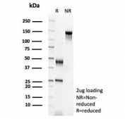 SDS-PAGE analysis of purified, BSA-free Epidermal Growth Factor Receptor antibody (clone EGFR/8933R) as confirmation of integrity and purity.