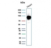 Western blot testing of human heart tissue lysate with CD36 Antibody Mouse Monoclonal CD36/7218. Expected molecular weight: 53-88 kDa depending on level of glycosylation.