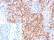 CD36 Antibody Mouse Monoclonal CD36/7218 IHC staining of FFPE human spleen tissue. The mouse monoclonal antibody (clone CD36/7218) demonstrates prominent membranous HRP-DAB brown staining in splenic macrophages and sinusoidal endothelial cells, consistent with Platelet glycoprotein 4 / CD36 expression, while most lymphoid cells show minimal staining. The antibody was applied at 2ug/ml. The inset shows PBS used in place of the primary antibody as a secondary-only negative control. Heat-induced epitope retrieval was performed in 10mM Tris with 1mM EDTA, pH 9.0, at 95oC for 20 minutes followed by cooling before testing.