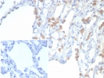 EPHB4 Antibody Human Lung IHC. Immunohistochemistry analysis of FFPE human lung tissue using EPHB4 Antibody (clone EPHB4/6392) demonstrates HRP-DAB brown membranous and cytoplasmic staining in epithelial and vascular-associated cells, consistent with Eph receptor B4 / EPHB4 expression as a receptor tyrosine kinase involved in cell signaling and vascular biology, while surrounding stromal elements show lower signal; nuclei are counterstained blue. Inset: PBS used in place of primary antibody shows minimal background staining, confirming specificity. HIER: boil tissue sections in pH 9 10 mM Tris with 1 mM EDTA for 20 min and allow to cool before testing.