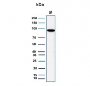 LI Cadherin Antibody WB. Western blot analysis of human small intestine tissue lysate using LI Cadherin Antibody / CDH17 Antibody (recombinant mouse monoclonal clone rCDH17/8514) demonstrates a strong immunoreactive band at approximately 100-110 kDa, consistent with expression of Cadherin 17 (CDH17, LI-cadherin). CDH17 is a calcium-dependent cell adhesion molecule predominantly expressed in gastrointestinal epithelial tissues, where it contributes to epithelial organization, maintenance of tissue integrity, and regulation of cell-cell interactions. The observed molecular weight is higher than the predicted size of approximately 92 kDa, a finding commonly attributed to extensive glycosylation of the extracellular domain. Such post-translational modification frequently results in slower electrophoretic migration and an increased apparent molecular weight during western blot analysis. The observed banding pattern is consistent with expected glycosylated CDH17 expression in human small intestinal epithelium. Predicted molecular weight: approximately 92 kDa.