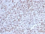 EZH2 Antibody Human Tonsil IHC. Immunohistochemistry staining of FFPE human tonsil tissue with EZH2 antibody (clone EZH2/6991). HIER: boil tissue sections in pH 9 10mM Tris with 1mM EDTA for 20 min and allow to cool before testing.