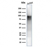 Enhancer of zeste homolog 2 Antibody WB. Western blot testing of human Jurkat cell lysate with Enhancer of zeste homolog 2 antibody (clone EZH2/6988). Expected molecular weight: 85-95 kDa.