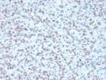 Enhancer of zeste homolog 2 Antibody Tonsil Tissue Immunohistochemistry. IHC staining of FFPE human tonsil tissue with Enhancer of zeste homolog 2 antibody (clone EZH2/4687). Inset: PBS used in place of primary Ab (secondary Ab negative control). HIER: boil tissue sections in pH 9 10mM Tris with 1mM EDTA for 20 min and allow to cool before testing.