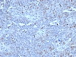 EZH2 Antibody Human Tonsil Lymphocyte IHC. Immunohistochemistry testing of FFPE human tonsil tissue with EZH2 antibody (clone EZH2/6989). HIER: boil tissue sections in pH 9 10mM Tris with 1mM EDTA for 20 min and allow to cool before testing.