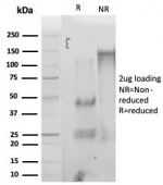 SDS-PAGE analysis of purified, BSA-free StAR Antibody Steroidogenic Cell Marker (clone STAR/3976) as confirmation of integrity and purity.
