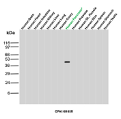 Carboxypeptidase A1 Antibody Tissue Panel WB. Western blot analysis of Carboxypeptidase A1 / CPA1 across human tissue lysates including brain, heart, intestine, kidney, liver, lung, ovary, pancreas, prostate, skeletal muscle, skin, spleen, stomach, and testis using rabbit monoclonal Carboxypeptidase A1 antibody, clone CPA1/8163R. A distinct band is detected at approximately 45 kDa exclusively in the pancreas lane, consistent with the predicted molecular weight of CPA1, demonstrating its highly restricted expression and supporting its use as a pancreatic acinar cell marker in tissue analysis.