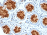Immunohistochemistry analysis of NTRK2 antibody (clone NTRK2/4672) in FFPE human colon tissue. HRP-DAB brown chromogenic staining is observed predominantly in the epithelial cells lining the colonic glands, with cytoplasmic and membranous localization in glandular epithelial cells. Surrounding stromal cells show minimal staining. Heat-induced epitope retrieval was performed by boiling tissue sections in pH 9 10mM Tris with 1mM EDTA for 20 min followed by cooling prior to immunostaining.