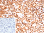 IHC staining of FFPE human spleen tissue with Adenylyl cyclase 8 antibody (clone ADCY8/7574). HIER: boil tissue sections in pH 9 10mM Tris with 1mM EDTA for 20 min and allow to cool before testing.