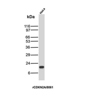Cyclin-dependent kinase inhibitor 2A Antibody HeLa WB. Western blot analysis of CDKN2A (p16INK4a) expression in HeLa cell lysate using Cyclin-dependent kinase inhibitor 2A antibody clone rCDKN2/8061. Lane 1: HeLa cell lysate. A band is detected at approximately 15â17 kDa, consistent with the predicted molecular weight of p16INK4a, a cyclin-dependent kinase inhibitor that regulates G1 cell cycle progression through inhibition of CDK4 and CDK6. The clear detection in HeLa cells supports the use of this clone for western blot analysis of proliferating cell lines.