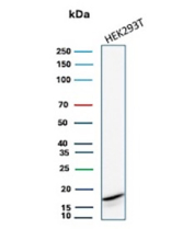 CDKN2A Antibody HEK293T WB. Western blot analysis of Cyclin-dependent kinase inhibitor 2A (p16INK4a) expression in HEK293T cell lysate using CDKN2A Antibody clone rCDKN2A/8004. Lane 1: HEK293T cell lysate. A band is detected at approximately 15-17 kDa, consistent with the predicted molecular weight of p16INK4a, a cyclin-dependent kinase inhibitor that regulates G1 cell cycle progression through inhibition of CDK4 and CDK6. A faint lower-molecular-weight band is also observed, which may represent proteolytic processing or non-specific reactivity.