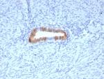 P16INK4a Antibody HeLa WB. Western blot analysis of Cyclin-dependent kinase inhibitor 2A (p16INK4a) expression in HeLa cell lysate using P16INK4a antibody clone rCDKN2/8062. Lane 1: HeLa cell lysate. A band is detected at approximately 15â17 kDa, consistent with the predicted molecular weight of p16INK4a, a cyclin-dependent kinase inhibitor that regulates G1 cell cycle progression through inhibition of CDK4 and CDK6. The clear signal supports the use of this clone for western blot analysis of proliferating cell lines.