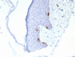 MART-1 Antibody Human Skin IHC. Immunohistochemistry staining of FFPE human skin tissue with MART-1 antibody (clone rMLANA/8134). HIER: boil tissue sections in pH 9 10mM Tris with 1mM EDTA for 20 min and allow to cool before testing.