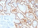 Immunohistochemistry analysis of B7-H1 antibody in human placenta. B7-H1 Antibody Recombinant Rabbit MAb PDL1/8809R was used for immunohistochemistry on FFPE human placental tissue. HRP-DAB brown membranous staining is observed in trophoblastic epithelial cells lining chorionic villi, consistent with the known cell surface localization of Programmed death-ligand 1 (PD-L1 / CD274), an immune checkpoint ligand involved in regulation of maternal-fetal immune tolerance. The staining highlights the trophoblastic layer surrounding placental villous structures, while underlying stromal components show minimal signal. The recombinant rabbit monoclonal antibody (clone PDL1/8809R) detects PD-L1 expression in placental epithelial cells within the villous architecture. Inset: PBS used in place of primary antibody as a secondary antibody negative control. HIER: boil tissue sections in pH 9 10mM Tris with 1mM EDTA for 20 min and allow to cool before testing.