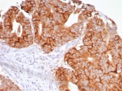 TNFSF15 Antibody Colon IHC. Immunohistochemistry of TNFSF15 antibody in human colon tissue. FFPE human colon shows membranous and cytoplasmic HRP-DAB brown staining within glandular epithelial cells, consistent with VEGI expression in vascular and epithelial compartments. Clone VEGI/7799R was used as a recombinant rabbit monoclonal antibody for detection. Heat-induced epitope retrieval was performed by boiling tissue sections in pH 9, 10 mM Tris with 1 mM EDTA for 20 minutes followed by cooling prior to staining.