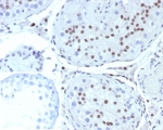 Steroidogenic Factor 1 Antibody Testis IHC. Immunohistochemistry analysis of FFPE human testis tissue stained with Steroidogenic Factor 1 Antibody demonstrates distinct nuclear HRP-DAB brown staining within seminiferous tubule-associated cellular populations, consistent with expression of steroidogenic factor 1 / NR5A1 in gonadal and endocrine-associated transcriptionally active compartments. This steroidogenic transcription factor antibody highlights nuclear localization patterns associated with reproductive tissue differentiation and steroidogenic signaling pathways. Inset: PBS was used in place of primary antibody as a negative control to assess non-specific secondary antibody binding. HIER: boil tissue sections in pH 9 10mM Tris with 1mM EDTA for 20 min and allow to cool before testing.
