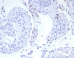 SF-1 Antibody Testis Immunohistochemistry. IHC staining of FFPE human testis tissue with SF-1 antibody (clone SF1/8150R). HIER: boil tissue sections in pH 9 10mM Tris with 1mM EDTA for 20 min and allow to cool before testing.