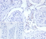 SF-1 Antibody Human Testis Tissue Immunohistochemistry. IHC staining of FFPE human testis tissue with SF-1 antibody (clone SF1/8150R). Inset: PBS used in place of primary Ab (secondary Ab negative control). HIER: boil tissue sections in pH 9 10mM Tris with 1mM EDTA for 20 min and allow to cool before testing.