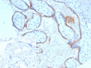 ENG Antibody Human Placenta Tissue IHC. Immunohistochemistry staining of FFPE human placental tissue with ENG antibody (clone ENG/8069R) Inset: PBS used in place of primary Ab (secondary Ab negative control). HIER: boil tissue sections in pH 9 10mM Tris with 1mM EDTA for 20 min and allow to cool before testing.