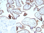 CD105 Antibody Placenta IHC. Immunohistochemistry staining of FFPE human placental tissue with Endoglin / CD105 antibody (clone ENG/8961R) Inset: PBS used in place of primary Ab (secondary Ab negative control). HIER: boil tissue sections in pH 9 10mM Tris with 1mM EDTA for 20 min and allow to cool before testing.