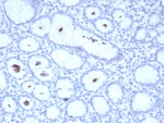 IHC staining of FFPE human H. pylori-infected stomach tissue with Helicobacter pylori antibody (clone HPYL/8548R). HIER: boil tissue sections in pH 9 10mM Tris with 1mM EDTA for 20 min and allow to cool before testing.