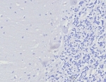 Negative control: IHC testing of FFPE human brain tissue with FOXP3 antibody (clone FOXP3/8277R) at 2ug/ml. HIER: boil tissue sections in pH 9 10mM Tris with 1mM EDTA for 20 min and allow to cool before testing.