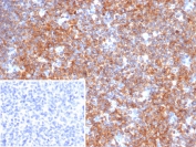 Immunohistochemistry analysis of BCL-6 corepressor antibody in human tonsil tissue (clone BCOR/2372). FFPE human tonsil tissue shows strong nuclear HRP-DAB brown staining in lymphoid cells, consistent with nuclear localization of BCL-6 corepressor / BCOR in proliferating and activated lymphoid populations. Staining is predominantly nuclear with minimal background in surrounding stromal elements. The inset image represents the negative control in which PBS was used instead of the primary antibody, demonstrating absence of specific nuclear staining. Heat induced epitope retrieval was performed by boiling tissue sections in pH 9 10mM Tris with 1mM EDTA for 20 minutes followed by cooling prior to immunostaining.