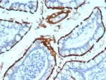 ACE2 Antibody (clone ACE2/7203) with human small intestine tissue. Immunohistochemistry staining of FFPE human small intestine demonstrates membranous and cytoplasmic staining in epithelial cells lining the intestinal villi, consistent with the known epithelial localization of Angiotensin Converting Enzyme 2 / ACE2. The antibody was applied at 2 ug/ml following heat-induced epitope retrieval by boiling tissue sections in pH 9 Tris buffer with 1 mM EDTA for 20 min. Brown chromogenic signal highlights ACE2-positive intestinal epithelial cells while surrounding stromal elements remain largely negative.