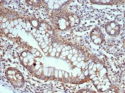 Calbindin D9K Antibody Small Intestine Tissue IHC. Immunohistochemistry analysis of Calbindin D9K S100G expression in FFPE human small intestine tissue using Calbindin D9K antibody clone S100G/7516. Strong cytoplasmic staining is observed in intestinal epithelial cells lining the villi, consistent with the role of this calcium-binding protein in transcellular calcium absorption, while underlying stromal cells show minimal signal. HIER: boil tissue sections in pH 9 10mM Tris with 1mM EDTA for 20 min and allow to cool before testing.