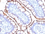 Angiotensin Converting Enzyme 2 Antibody for IHC (clone ACE2/8748R) in human small intestine tissue. Immunohistochemistry staining of FFPE human small intestine demonstrates strong membranous and cytoplasmic staining in epithelial cells lining the intestinal villi, consistent with the known epithelial distribution of ACE2 / Angiotensin-converting enzyme 2. The recombinant rabbit monoclonal antibody was applied at 2 ug/ml following heat-induced epitope retrieval by boiling tissue sections in pH 9 Tris with 1 mM EDTA for 20 min. Brown chromogenic signal highlights ACE2-positive intestinal epithelial cells while surrounding stromal elements remain largely negative.
